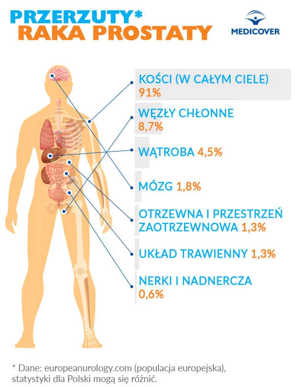 środki higieniczne dla gejów pieluchy